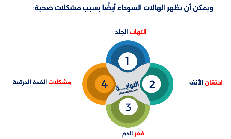 أفضل كريم للهالات السوداء