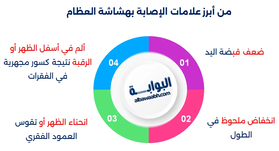 أعراض هشاشة العظام