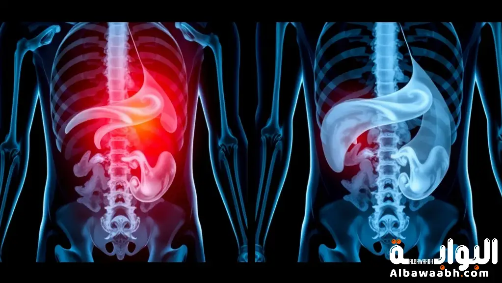 التخلص من ألم البطن