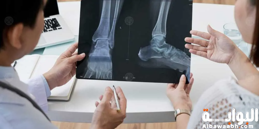 حلم تكسير العظام