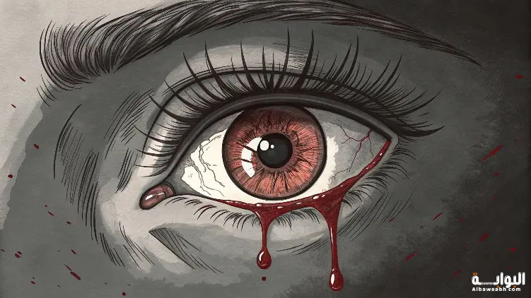 حلم رؤية الدم يخرج من العين