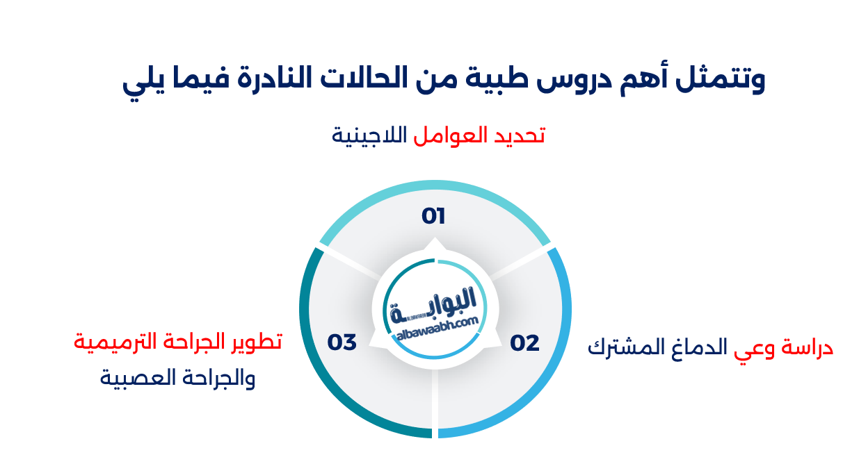 أغرب التوائم في العالم