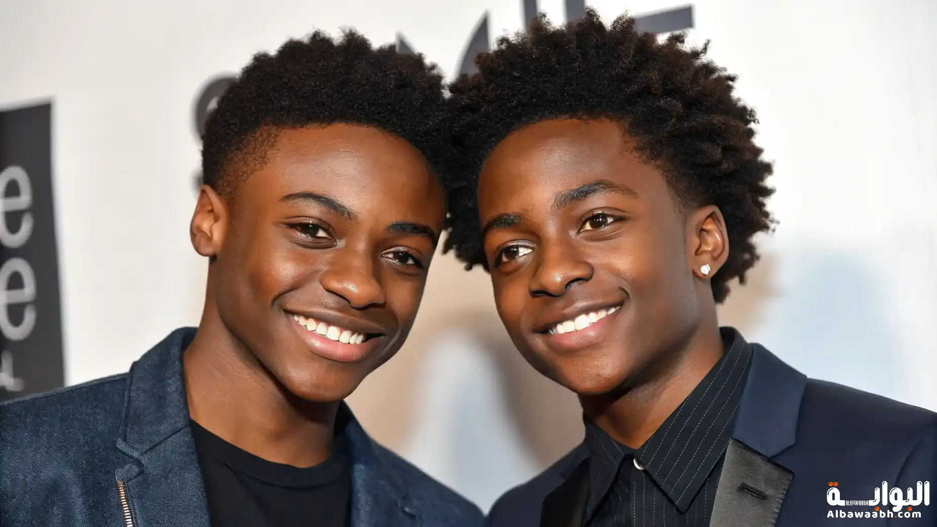 أغرب التوائم في العالم