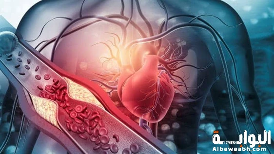 علاج ارتفاع الكوليسترول طبيعياً: طرق آمنة لتحسين صحتك